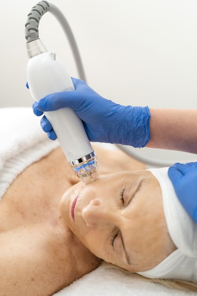 RF microneedling trinity beach cost