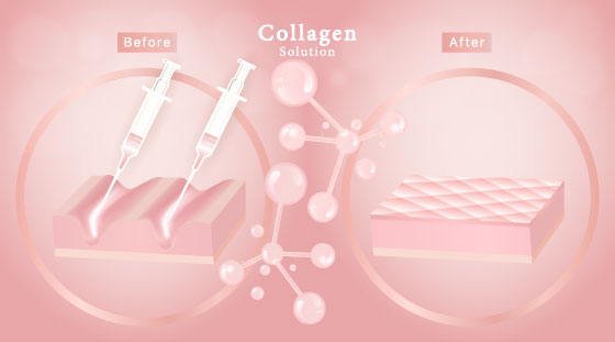 collagen stimulator trinity beach- Jade Cosmetic Clinic