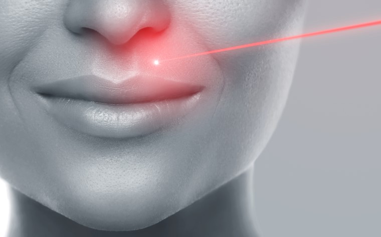 Laser treatment is an effective way to get rid of your vertical lip lines - Jade Cosmetic Clinic