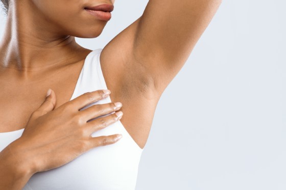 hyperhidrosis brisbane - Jade Cosmetic Clinic